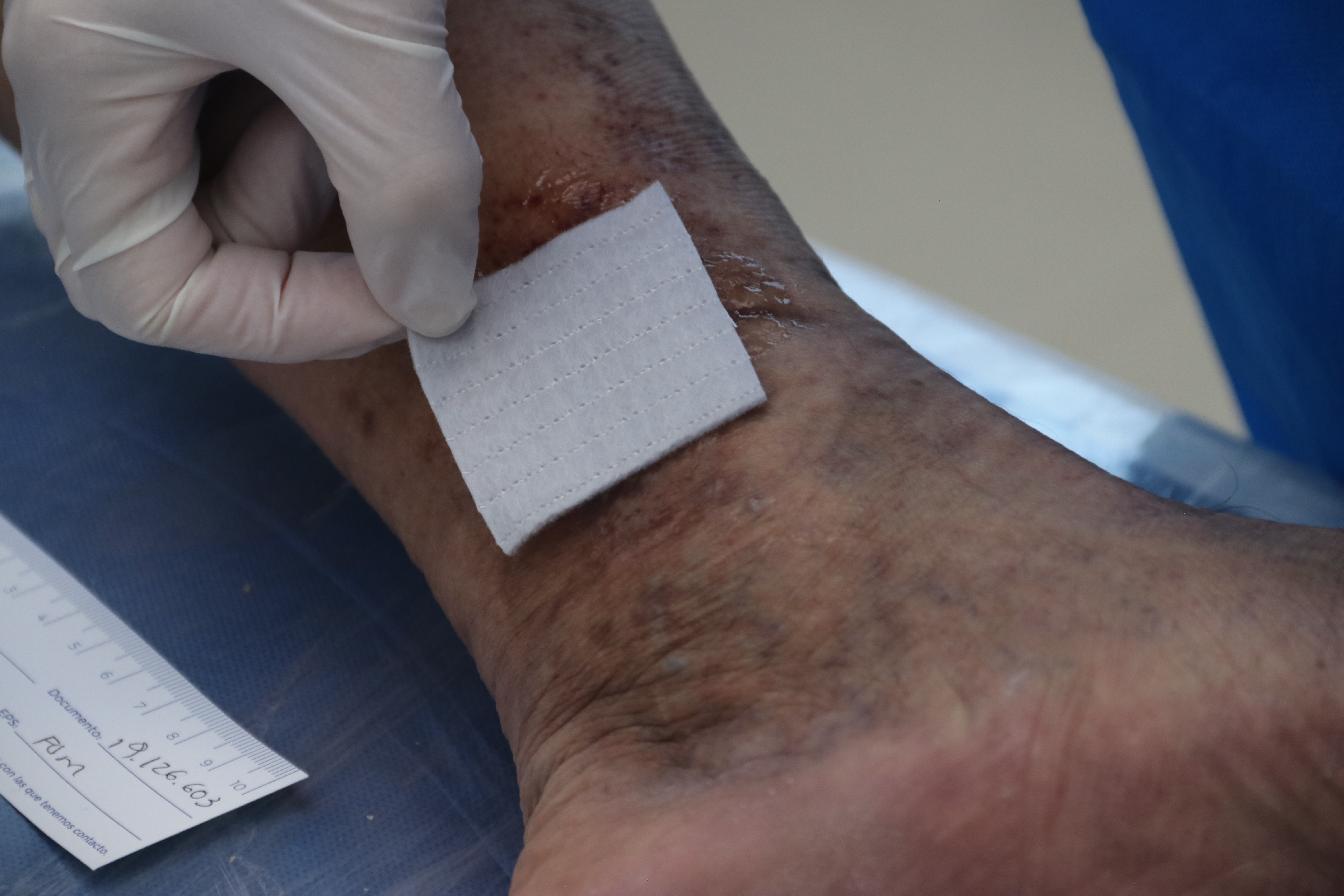 en klæbende bandage på et sår