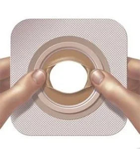 ConvaTec vormbare technologie™ huidbarrière